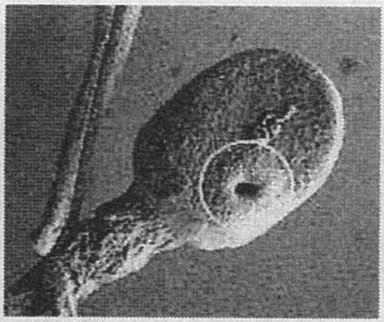 ヒト精子頭部の形態