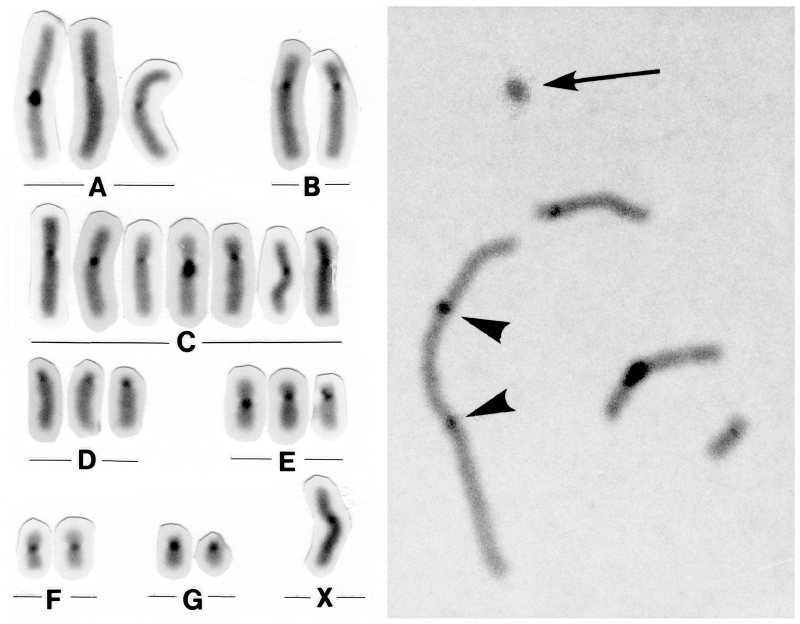 不動性精子の染色体異常