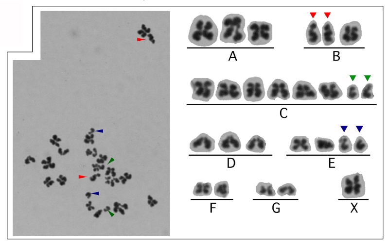 ヒト卵子の染色体