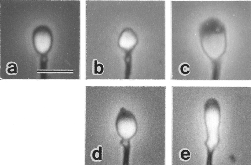 ヒト精子頭部の形態