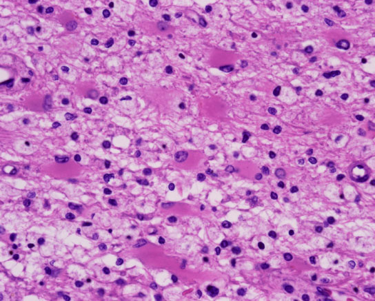Disease