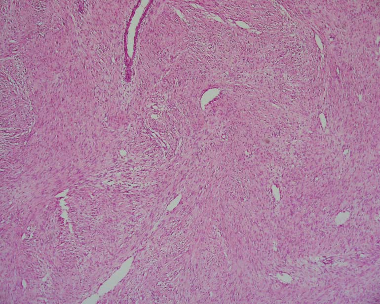 Disease