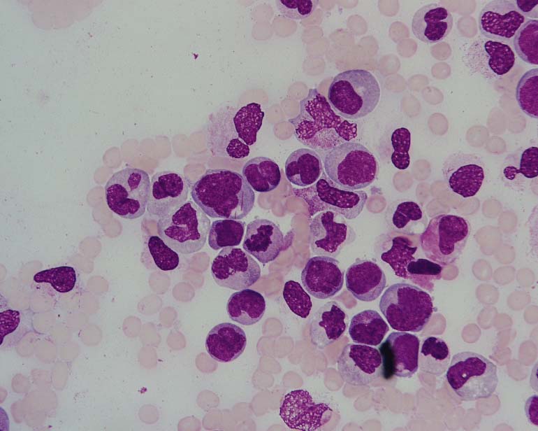 Disease Disease
