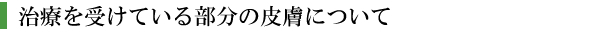 治療を受けている部分の皮膚について